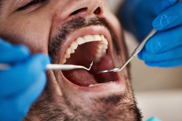 Best Emergency Dentist for Knocked-Out Tooth in Palisade, CO